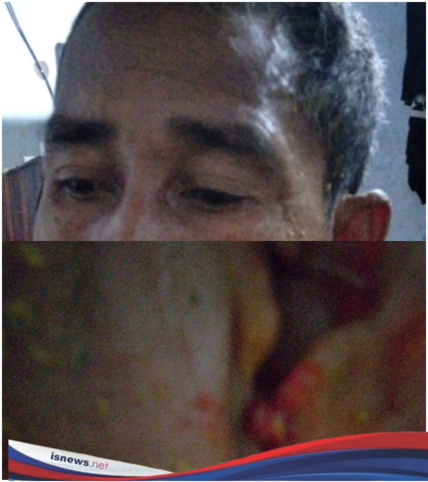 Kasus Penganiayaan Pak RT di Rasabou Jalan Ditempat, Keluarga Korban Pertanyakan Kinerja Polisi